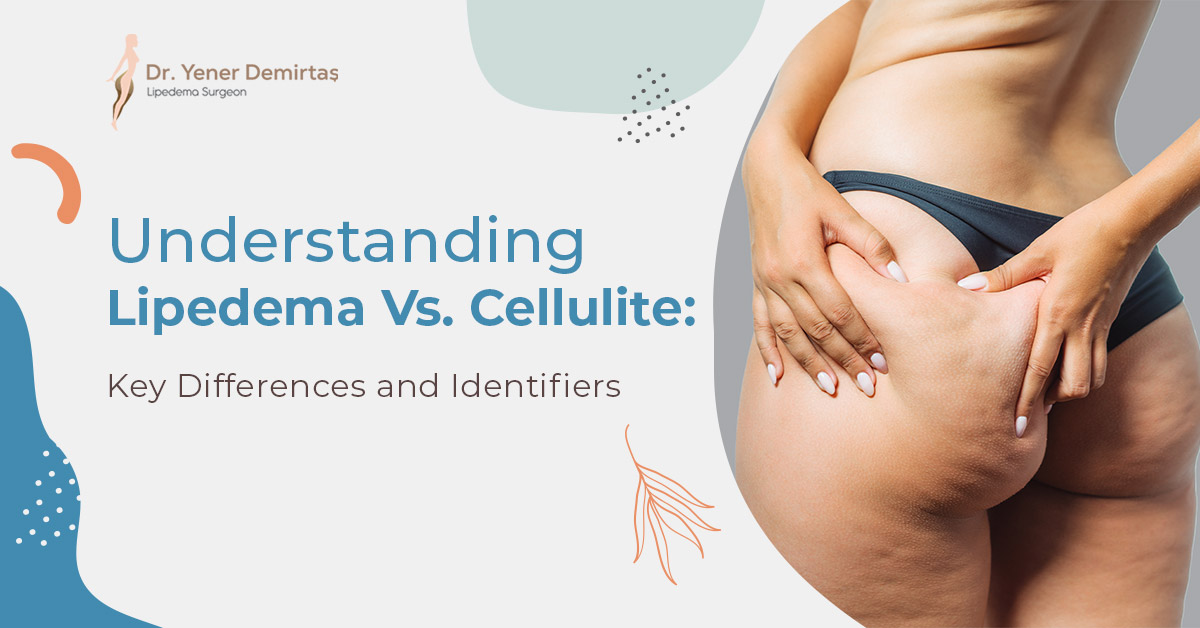 Differences in Lipedema and Cellulite: Causes & Treatments