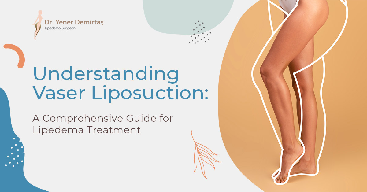 4 Things You Must Know Before a Lipedema Treatment